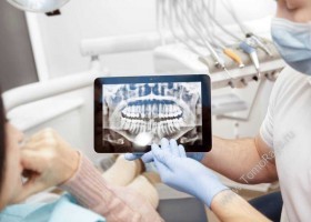 Рентген для стоматологии и ортопантомографы - TomoRays